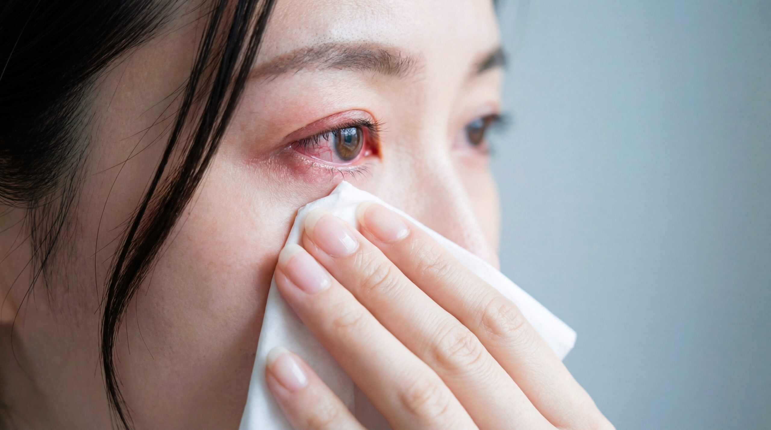 Shot of a woman wiping her irritated eye due to allergies.